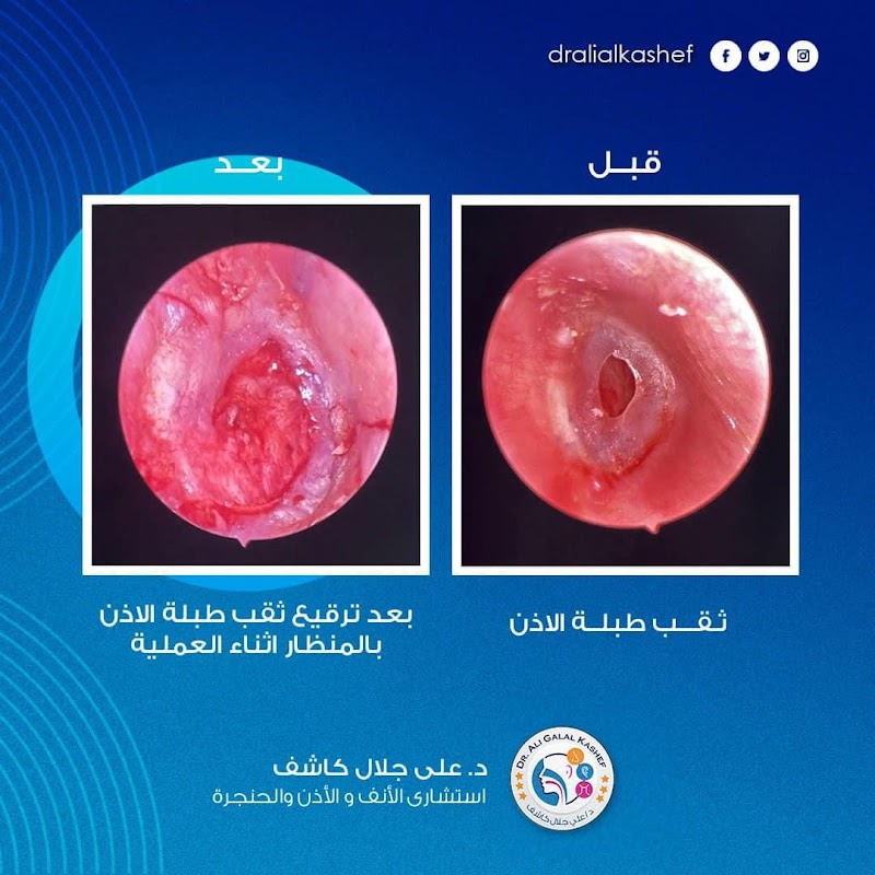 دكتور علي جلال كاشف عيادة بحري - Photo 3