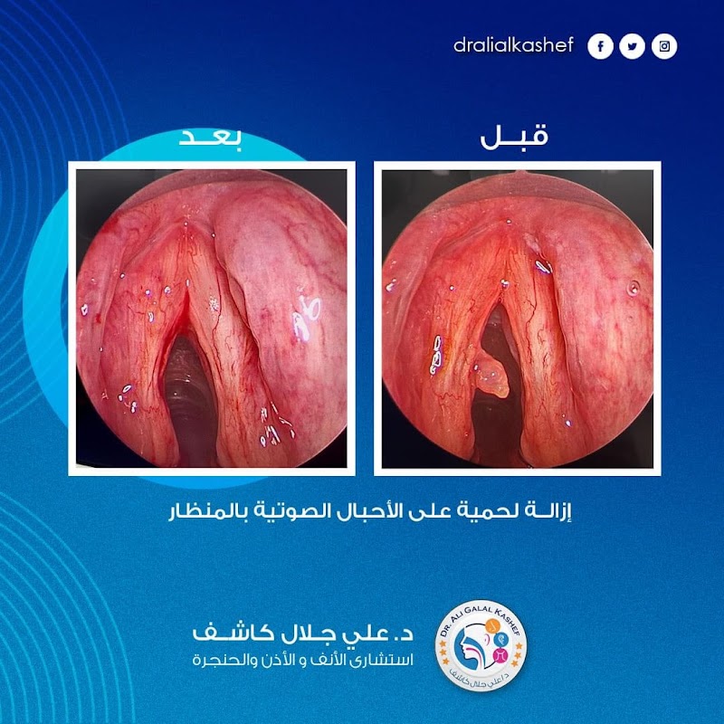 دكتور علي جلال كاشف عيادة بحري - Photo 1