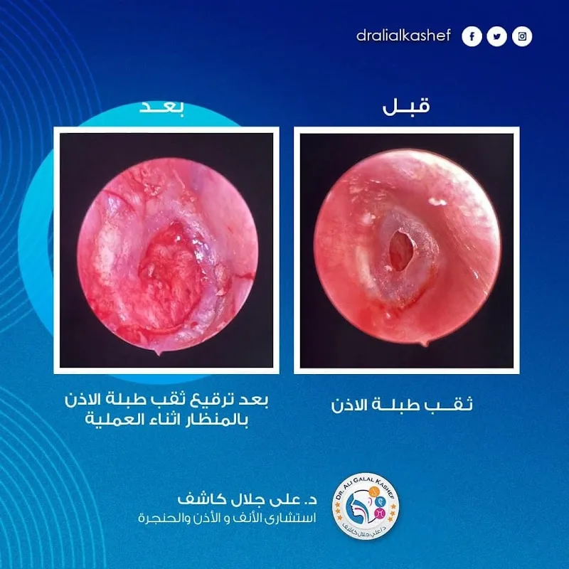 دكتور علي جلال كاشف عيادة بحري - Photo 3