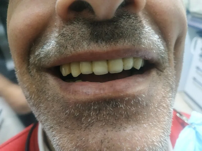 Dr. Bassem Samir Dental Clinic - Alex branch - Photo 1