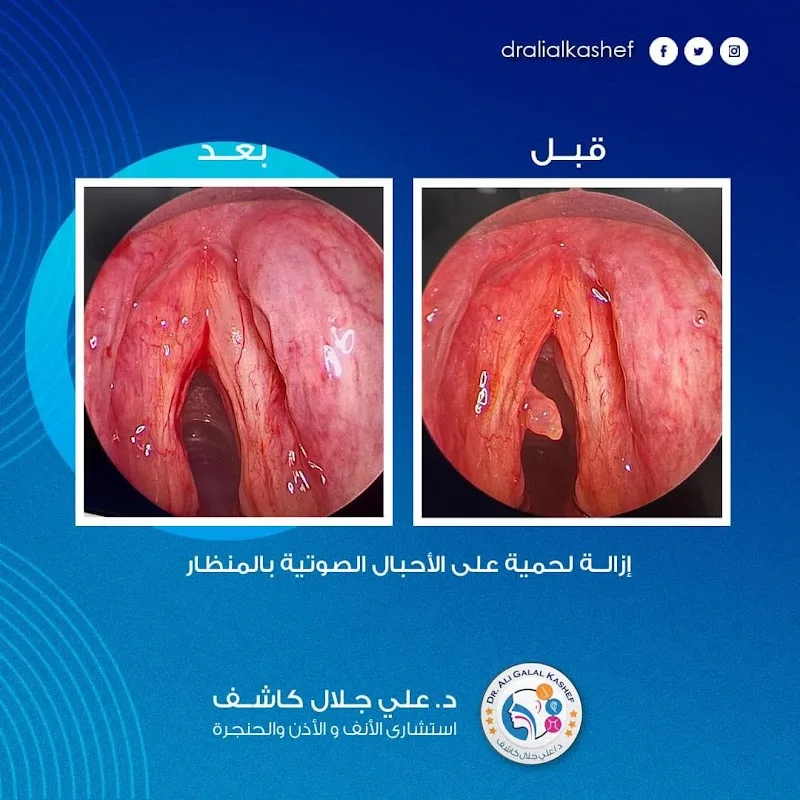 دكتور علي جلال كاشف عيادة بحري - Photo 1