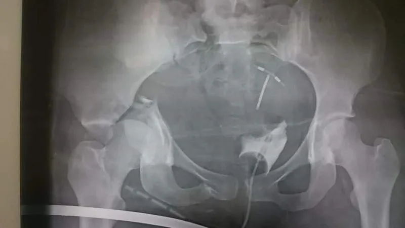 عيادة د خالد زغلول استشاري جراحة عظام الاطفال والعمود الفقري - صورة 3