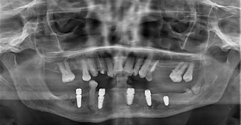 Etman Dental Clinics Centers - مركزعيادات عتمان لزراعة و تجميل الأسنان - صورة 3