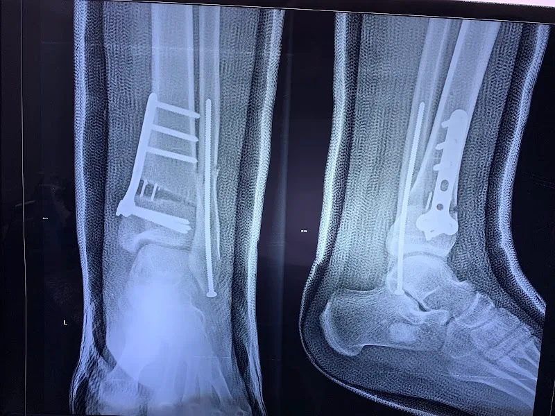 عيادة د خالد زغلول استشاري جراحة عظام الاطفال والعمود الفقري - صورة 1