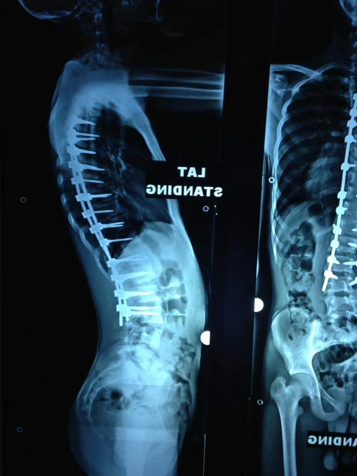 عيادة د خالد زغلول استشاري جراحة عظام الاطفال والعمود الفقري