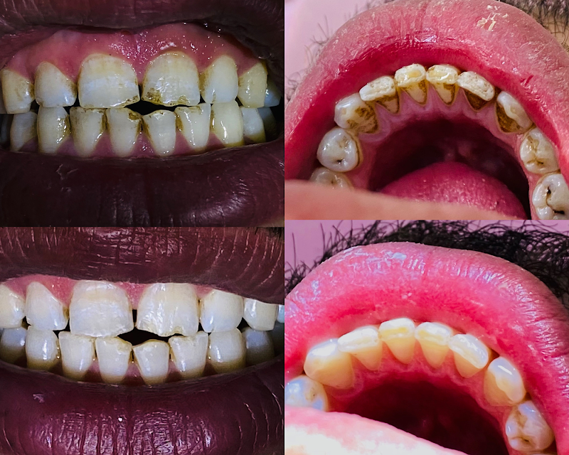 مركز اوبال للاسنان - صورة 3