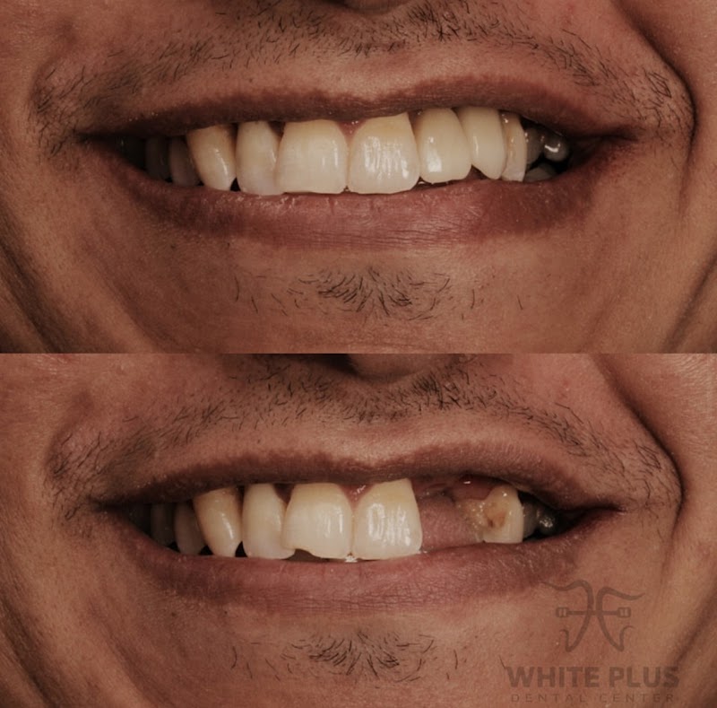 Dr. Abdelrahman Faisal - Dental Care Clinic - صورة 1