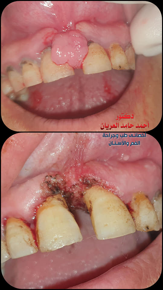 ELERYAN DENTAL CLINIC @ مركز الدكتور احمد العريان لطب الاسنان - Photo 2