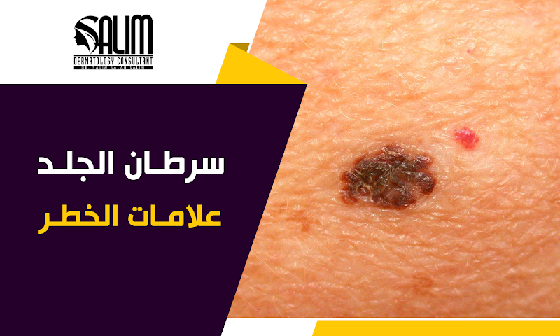 الدكتور/ سالم صلاح سالم استشاري الجلدية والتناسلية وأمراض الذكورة