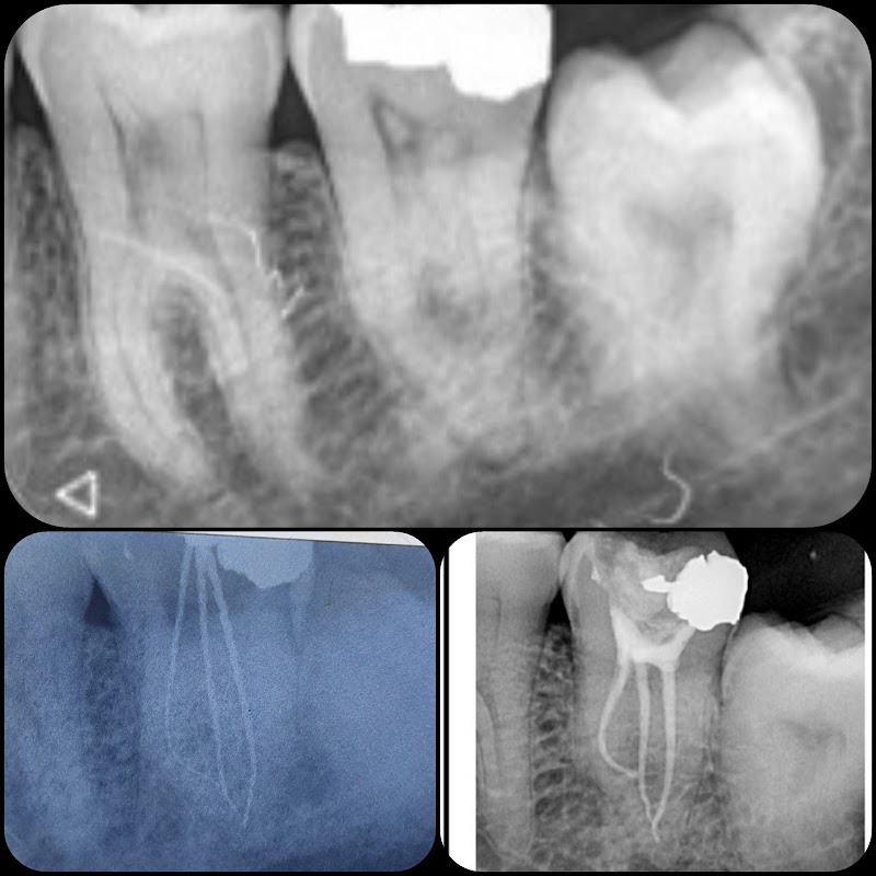 ELERYAN DENTAL CLINIC @ مركز الدكتور احمد العريان لطب الاسنان