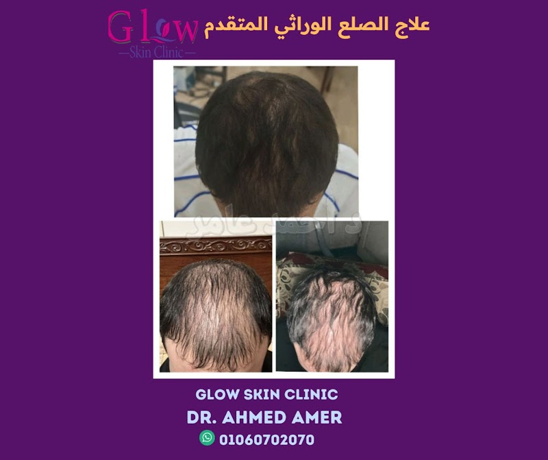 Glow Skin Clinic - صورة 2
