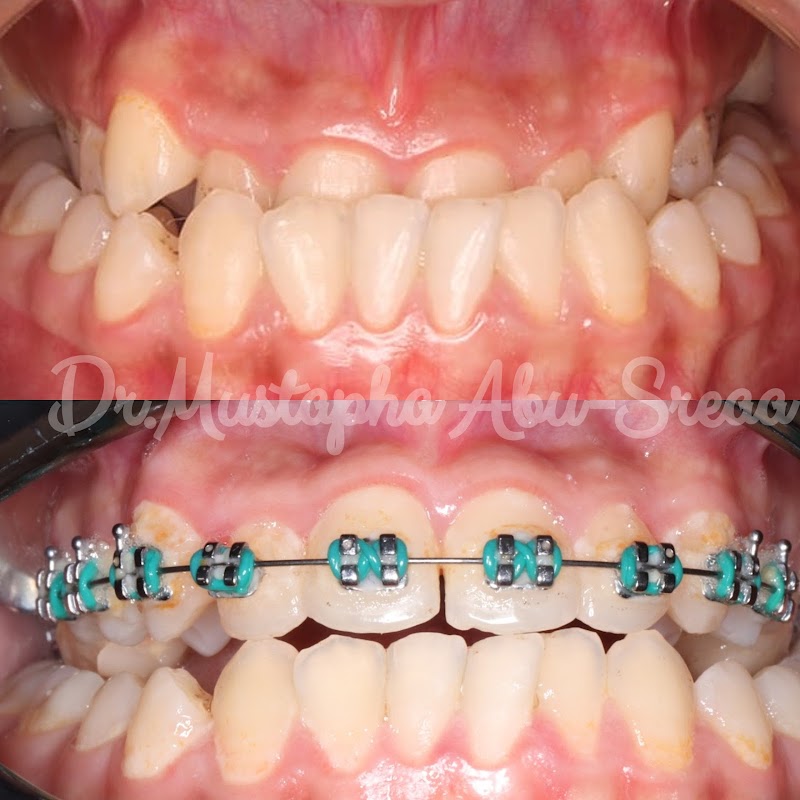 City Dental Care - Dr.Mustapha Abu-Sreaa