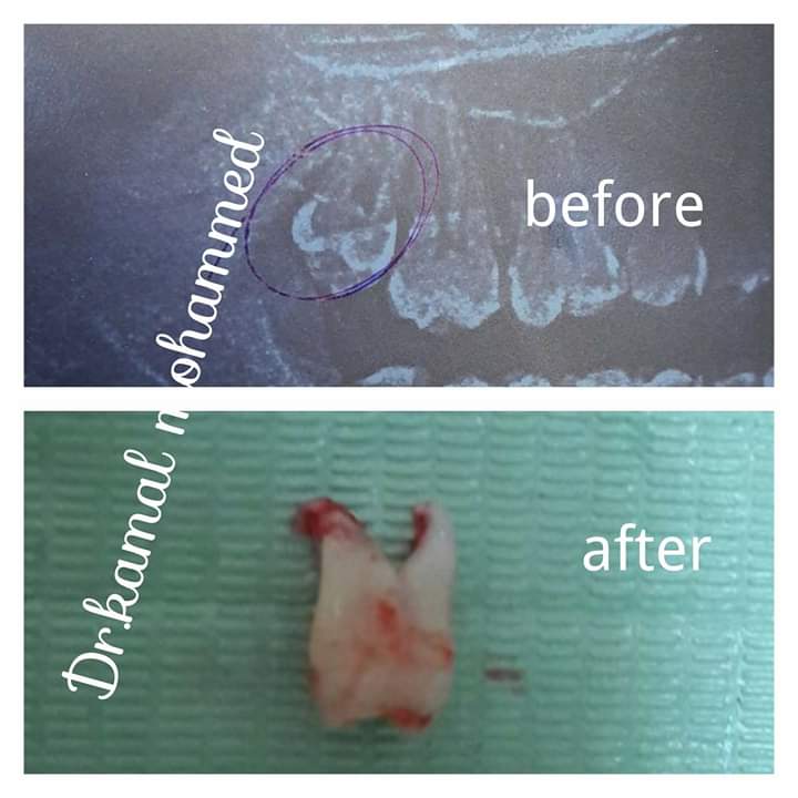 مركز دكتور كمال لطب الأسنان - Photo 3
