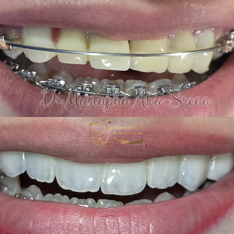 City Dental Care - Dr.Mustapha Abu-Sreaa - Photo 2