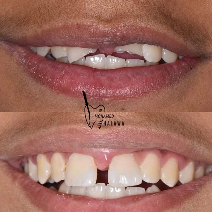 مركز البسمة لطب الاسنان دكتور طنطاوي الشحات - Photo 3
