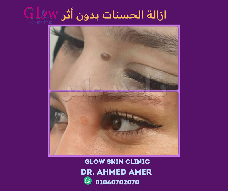 Glow Skin Clinic - صورة 1