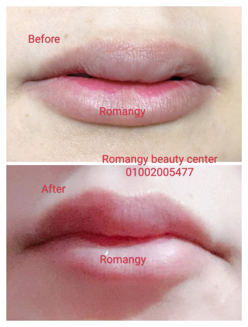 Romangy Beauty Center - Photo 3