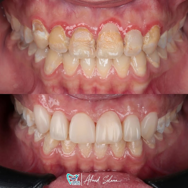 Dental Art Space عيادة د. أحمد سلامة لتجميل و تقويم الاسنان في دمنهور