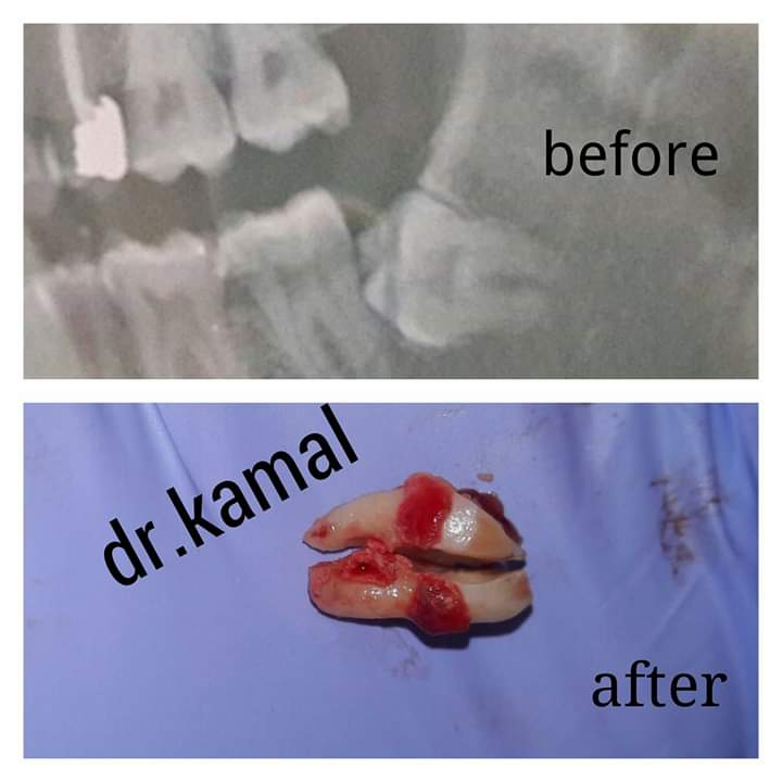 مركز دكتور كمال لطب الأسنان - Photo 1