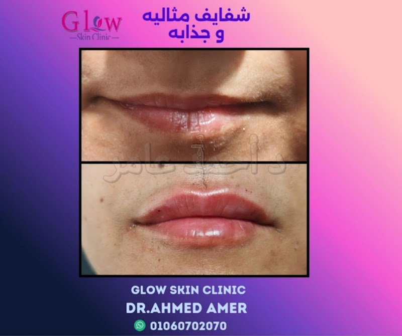 Glow Skin Clinic