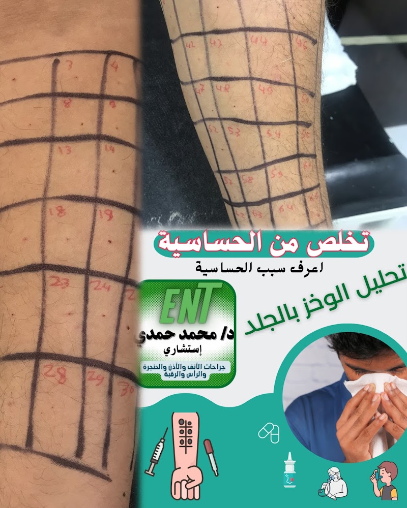عيادة دكتور محمد حمدي استشاري الانف والاذن والحنجرة بالمنيا