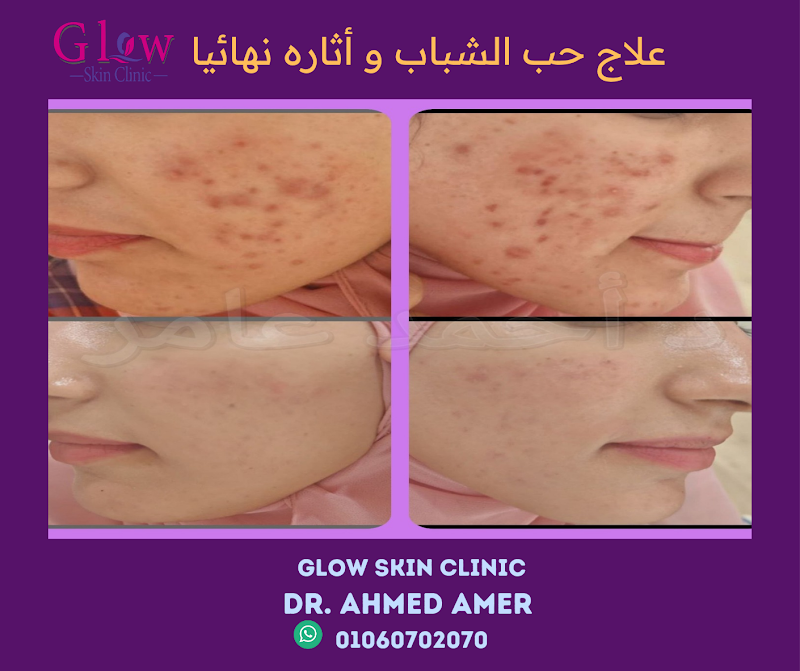 Glow Skin Clinic - صورة 3